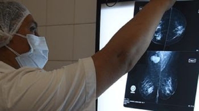 C&aacute;ncer de mama: con diagn&oacute;stico temprano la sobrevida alcanza al 90% de los casos