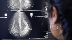 La detecci&oacute;n temprana de c&aacute;ncer de mama posibilita curaci&oacute;n en 9 de cada 10 casos