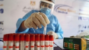 La Anmat aprob&oacute; el primer test argentino de diagn&oacute;stico basado en tecnolog&iacute;a RT-PCR