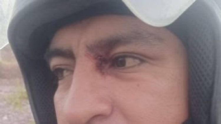 Polic&iacute;as heridos en un enfrentamiento de privados